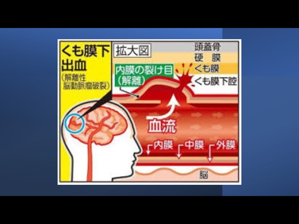 イチョウ葉製剤【血流の改善】